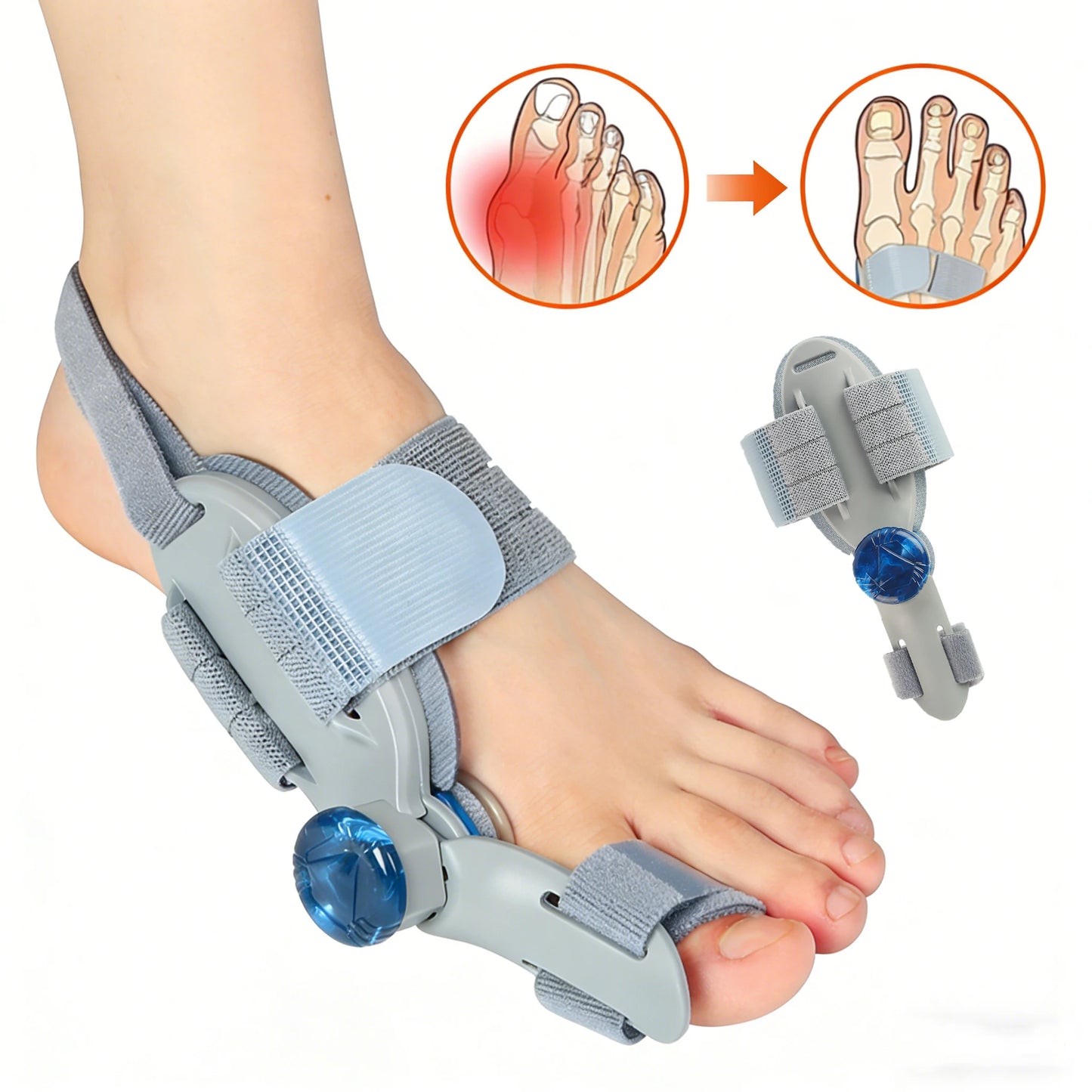 Moajaza Bunion Adjuster Knob Foot Brace For Hallux Valgus