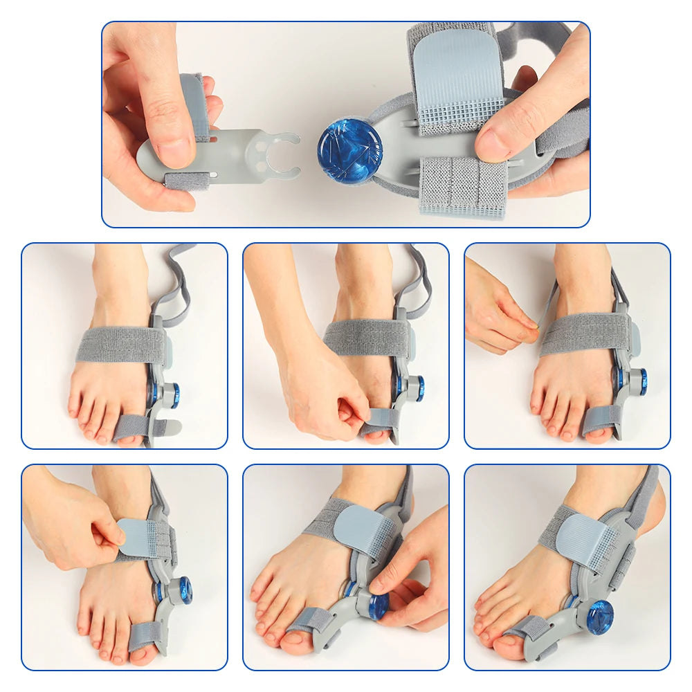 Moajaza Bunion Adjuster Knob Foot Brace For Hallux Valgus
