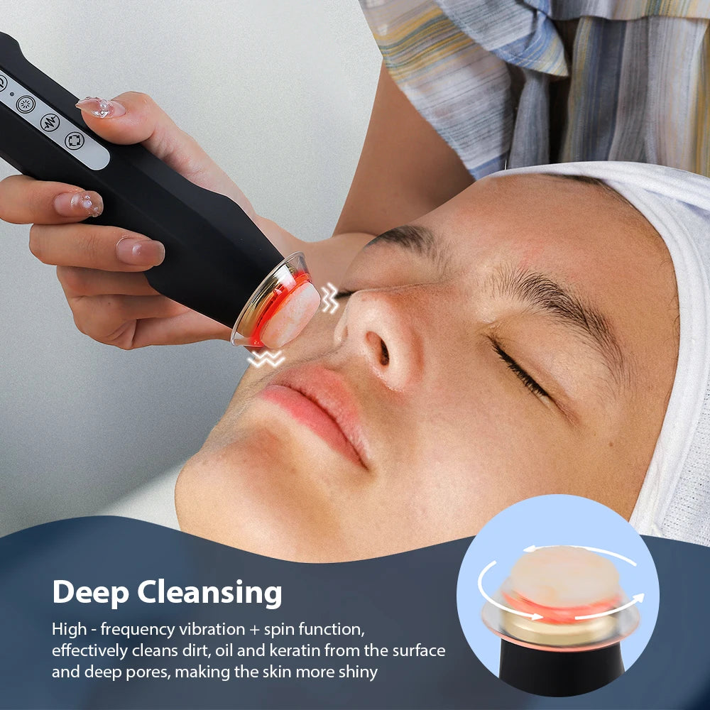 Foreverlily Oxygen Bubble Pen Facial CO2 Bubble Machine - Alice's Wellness Hub